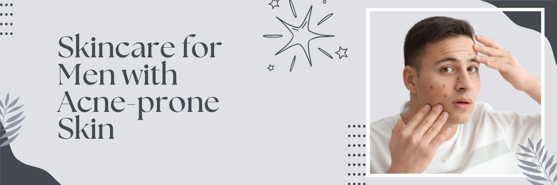 Skincare for Men with Acne-Prone Skin