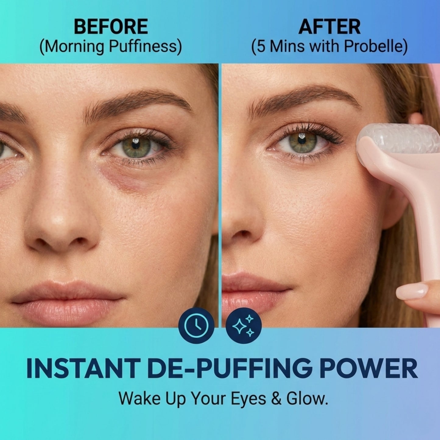 Probelle Premium Ice Roller