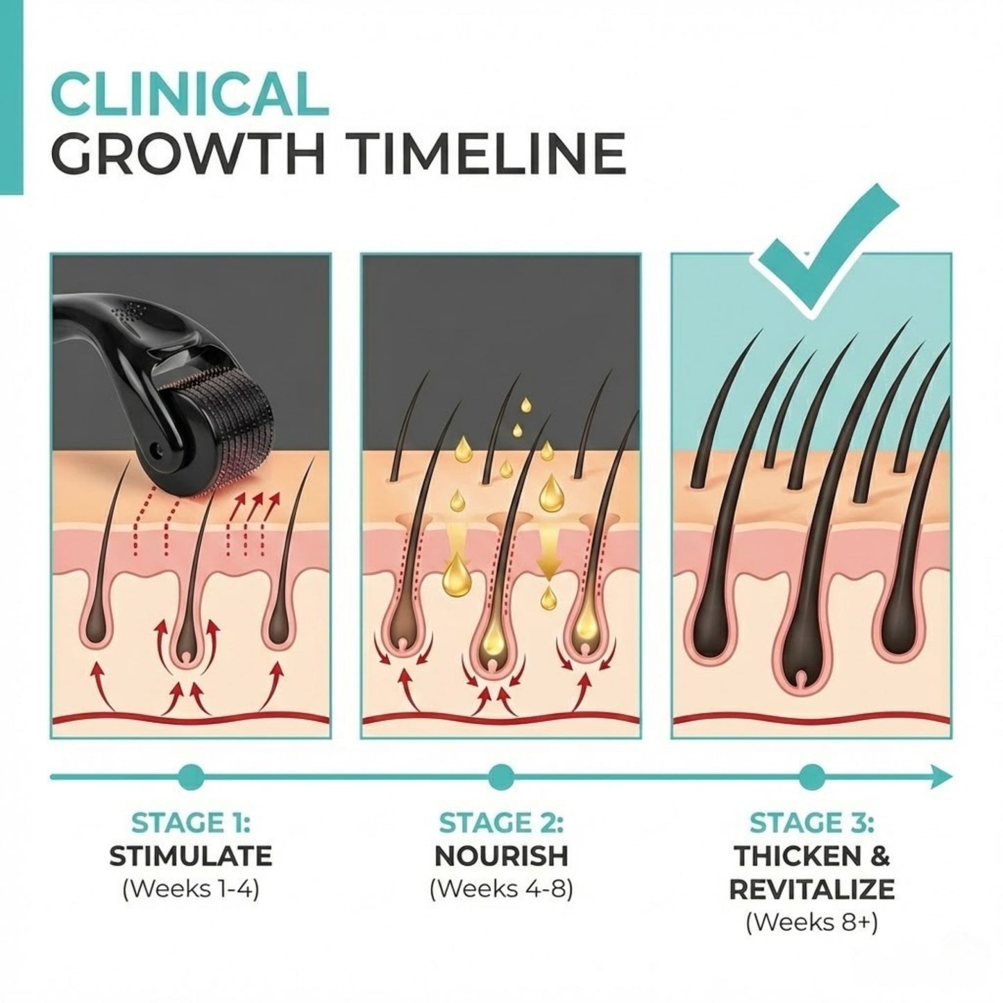 Probelle 0.5mm Derma Roller for Hair Regrowth