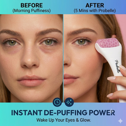 Probelle Premium Ice Roller